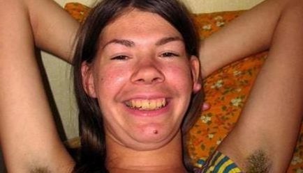 Сърбеж след бръснене на интимни части 5 obezkosmqvane