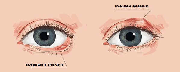 Антибиотичен крем за ечемик 04