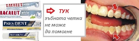 Размекване и разтваряне на зъбен камък. Хранене след почистване 13 четки за зъби