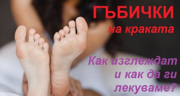 гъбички по краката