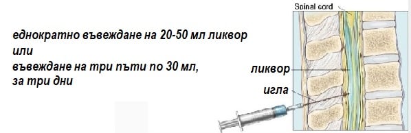 Хидроцефалия (вода в главата) при деца и възрастни. Различия, симптоми, терапия 6 симптоми на хидроцефалия, лечение