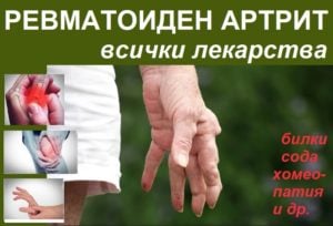 Ревматоиден артрит: първи признаци, диагностика. Лекарства, алтернативни терапии 3 Ревматоиден артрит, Лечение